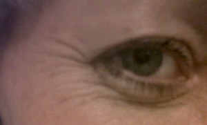 laughter lines?  No.  Nothing is THAT funny!