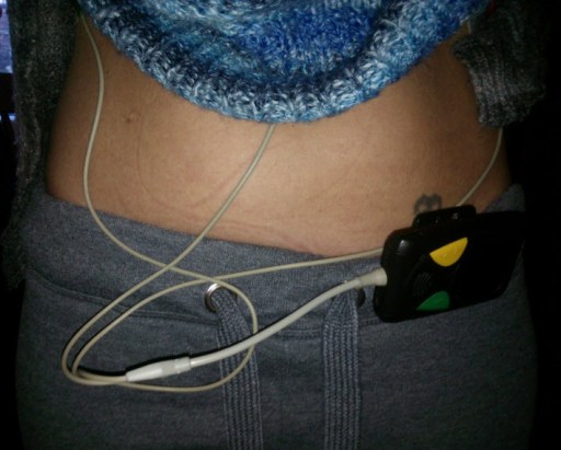 11th February 2014:  The latest Bumpkinsville accessory:  a 24 hour ECG machine.  It's a long story...I'll tell you another time.