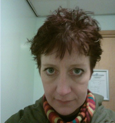 7th March 2014: Post EEG hair.  They stick thingys to your head with a cross between lard and hair gel that makes your hair solid.  I had a two hour journey home.  Thank god I hat a hat in my bag...